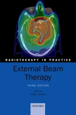 Terapie vnějším paprskem - External Beam Therapy