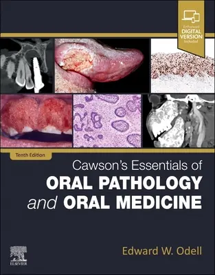 Cawsonovy základy ústní patologie a ústní medicíny - Cawson's Essentials of Oral Pathology and Oral Medicine