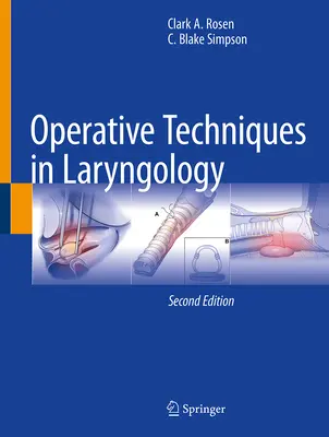 Operační techniky v laryngologii - Operative Techniques in Laryngology