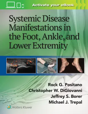 Projevy systémových onemocnění na noze, kotníku a dolní končetině - Systemic Disease Manifestations in the Foot, Ankle, and Lower Extremity