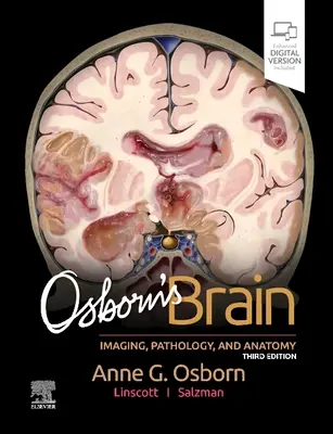 Osbornův mozek - Osborn's Brain