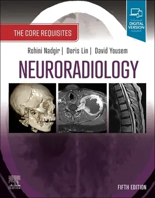 Neuroradiologie: Svazek 1: Základní požadavky - Neuroradiology: The Core Requisites